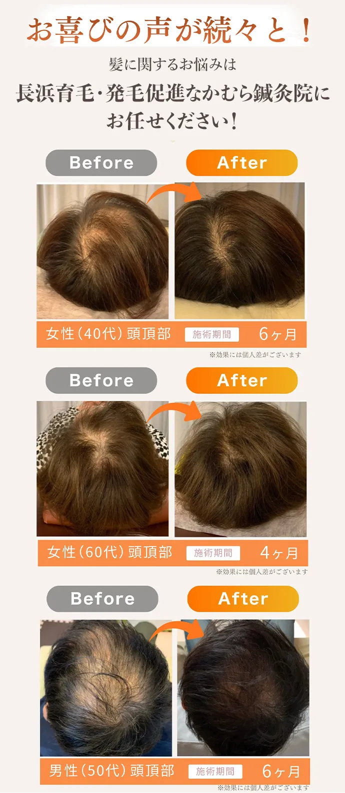 施術Before After