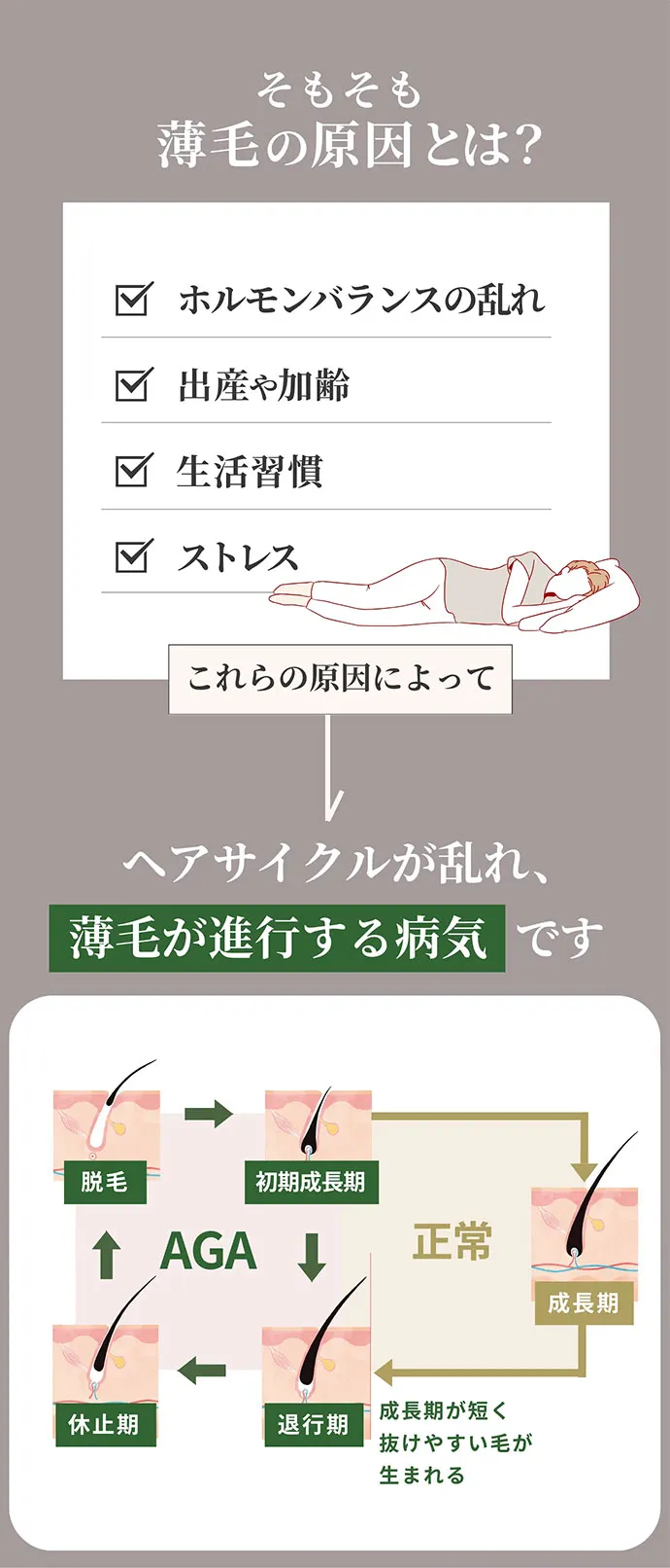 薄毛の原因